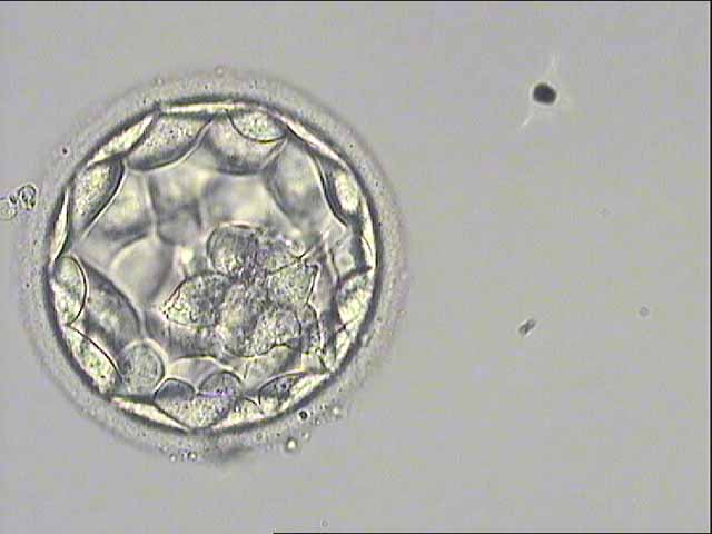 Fecundación in vitro - embrión