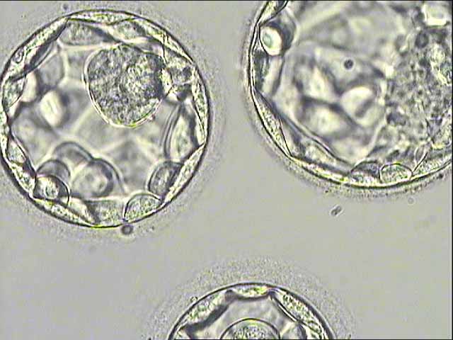 Fecundación in vitro - embrión