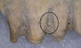 Restos de una ninfa de piojo de la cabeza entre los dientes del peine de Lachish.