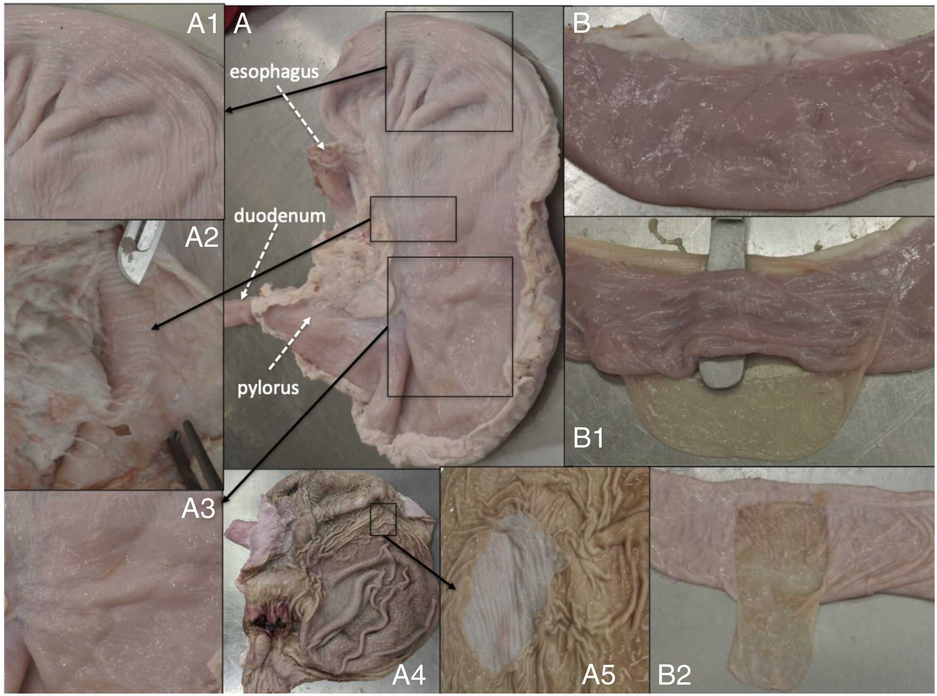 Fibras en el estómago y los intestinos. ( A ) Muestra un estómago aislado una vez retirado del abdomen. ( A 1 y A 3) son detalles en primer plano de la pared gástrica externa cubierta por la serosa (peritoneo visceral), a través del cual podemos visualizar pequeños surcos con diferentes direcciones. En A1 algunos surcos son paralelos al contorno natural del estómago y algunos son perpendiculares, mientras que en A3 la mayoría son perpendiculares. Después de retirar la serosa ( A 2), también se pueden ver surcos perpendiculares. A4 Muestra el estómago abierto para revelar su superficie interna (mucosa) con los pliegues de la mucosa, rugas . En A5 se ha retirado una porción de la mucosa para resaltar las direcciones contrastantes de las rugas y los surcos subyacentes de la capa muscular. ( B ) Muestra un segmento del intestino delgado. Después de separar su serosa ( B 1), se pueden intuir algunos surcos longitudinales. ( B 2) muestra las plicas o pliegues circunferenciales de la mucosa intestinal. En términos histológicos actuales, las arrugas gástricas ( A 4) y las plicas circunferenciales de los intestinos ( B 2) corresponden a los pliegues de la superficie mucosa interna de estos órganos. Los surcos que se observan en la pared externa ( A 1– A 3 y B 1), o tras retirar la mucosa del interior del estómago ( A 5), pertenecen a diferentes capas de músculo liso dentro de la estructura histológica del tubo digestivo. Estas capas de músculo liso permiten el movimiento de los órganos.
