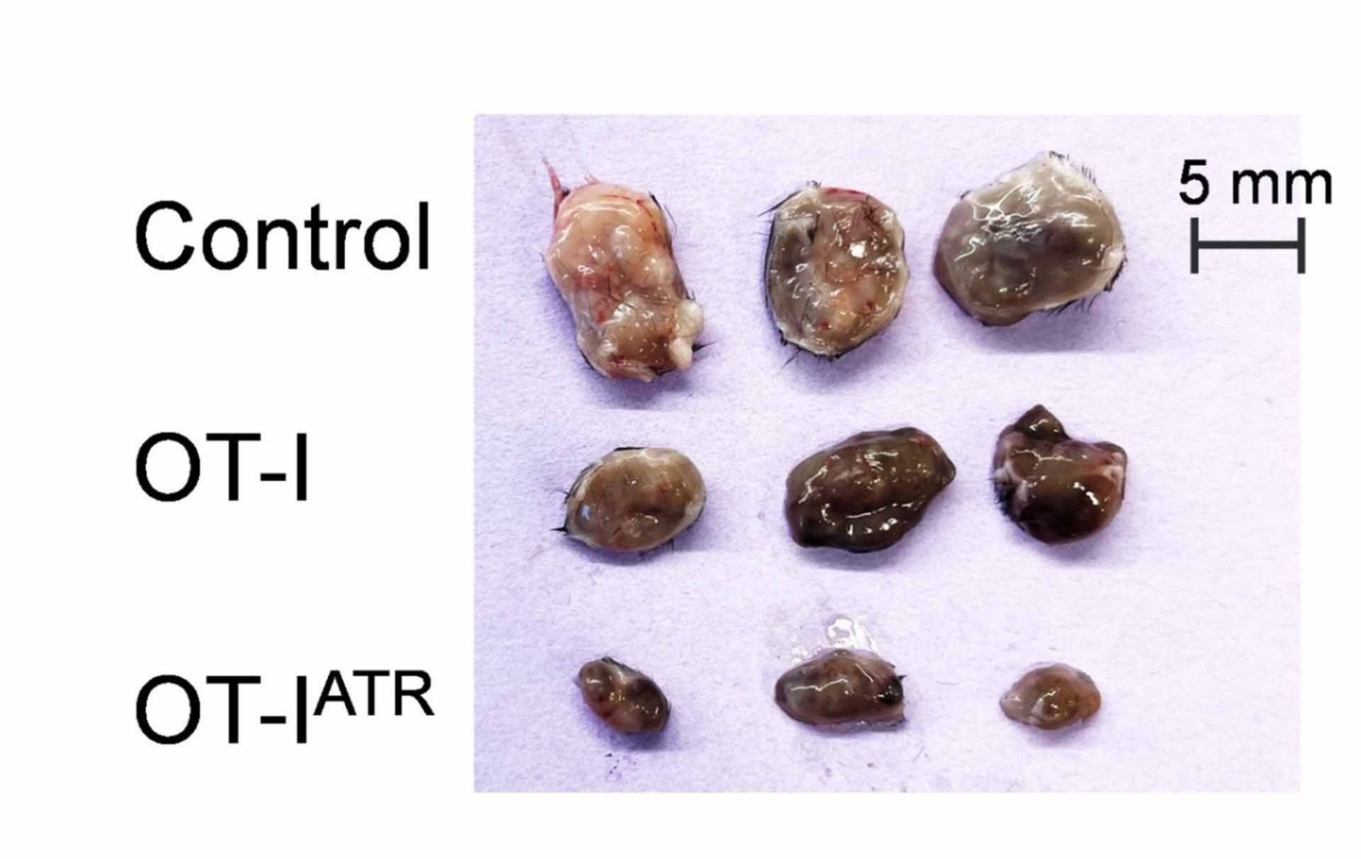 Esta imagen muestra los tumores recolectados al final del experimento de tres grupos experimentales: controles no tratados, receptores de células T OT-I CD8+ sin tratamiento adicional y aquellos que reciben células T OT-I CD8+ seguidas de terapia ATR. La barra de escala de 5 mm resalta las diferencias visibles en el volumen tumoral. El crecimiento se midió diariamente a partir del día 17 después de la implantación para evaluar la efectividad del tratamiento.
